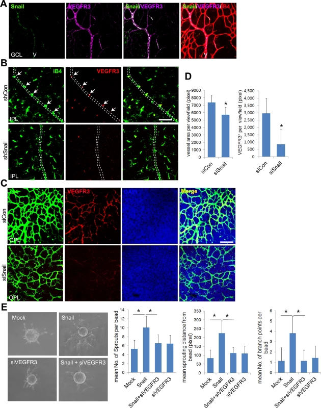 Snail knockdown attenuates VEGFR3 expression in the vertical vessel and the deep plexus.