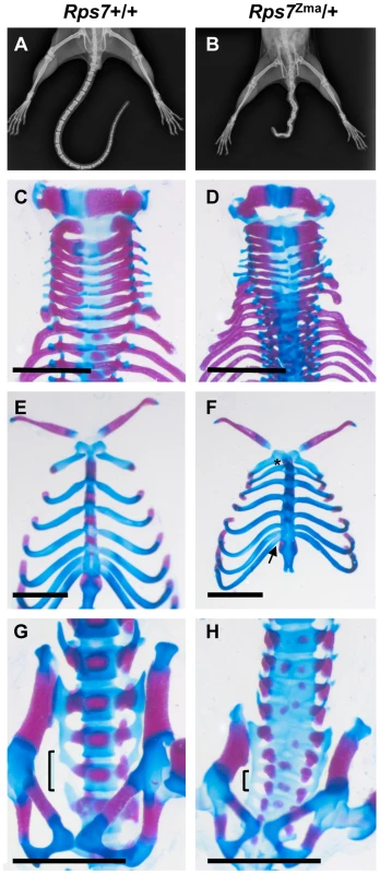 Skeletal abnormalities in <i>Rps7</i> mutants.