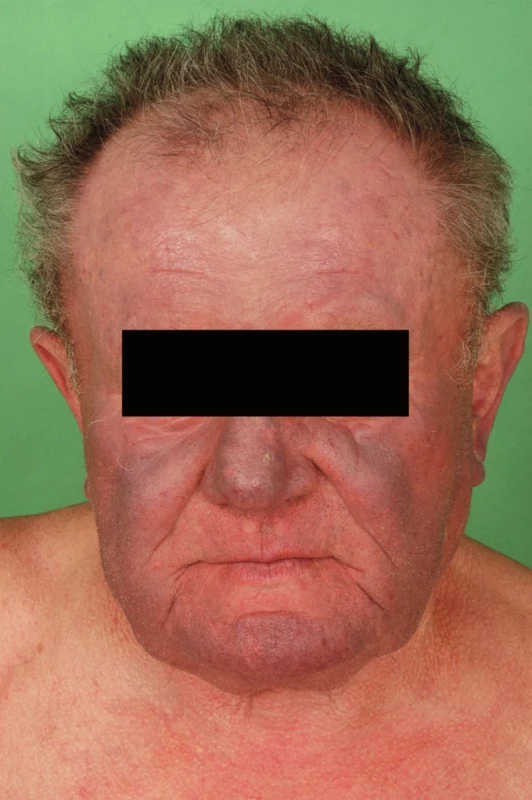 Pacient č. 3.