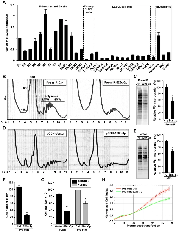 miR-520c-3p is downregulated in DLBCL cells and affects global gene translation and cell proliferation.