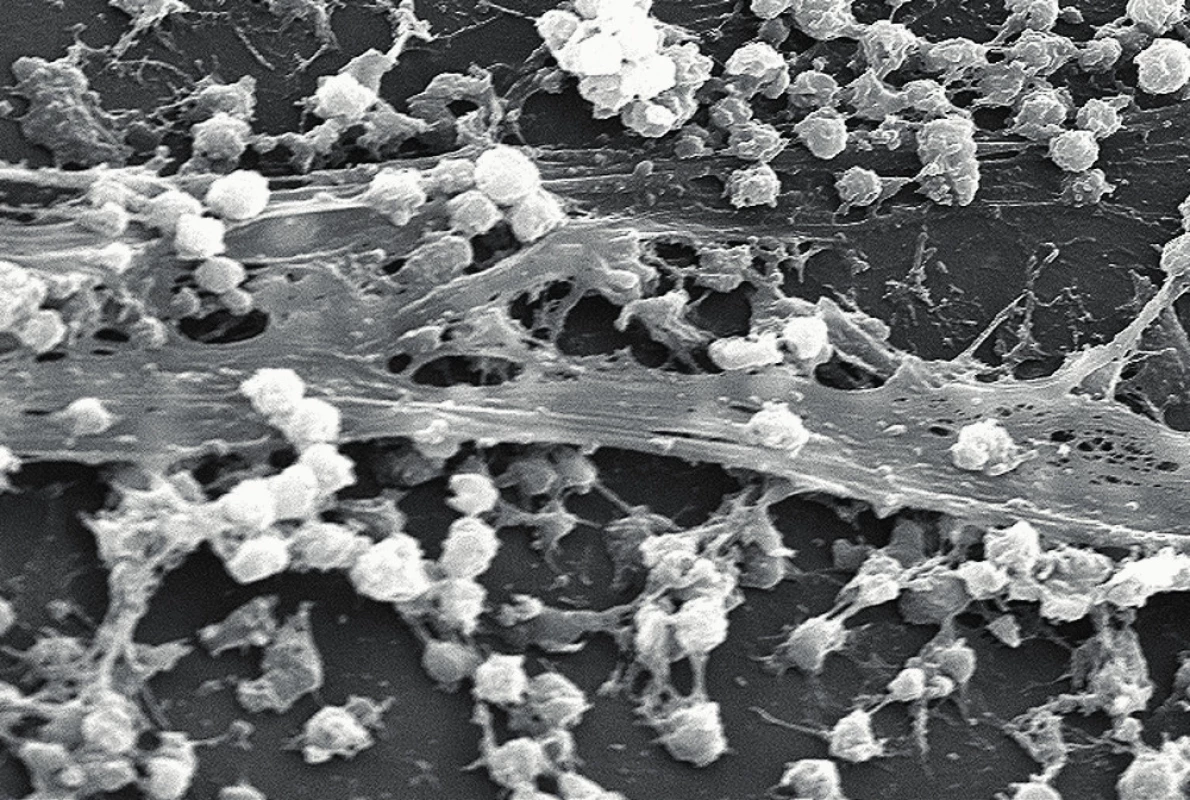 <em>Staphylococcus aureus</em> a biofilm na povrchu centrálního žilního katetru (převzato z Wikipedie).
Fig. 1. <em>Staphylococcus aureus</em> and the biofilm on the surface of central venous catheter.