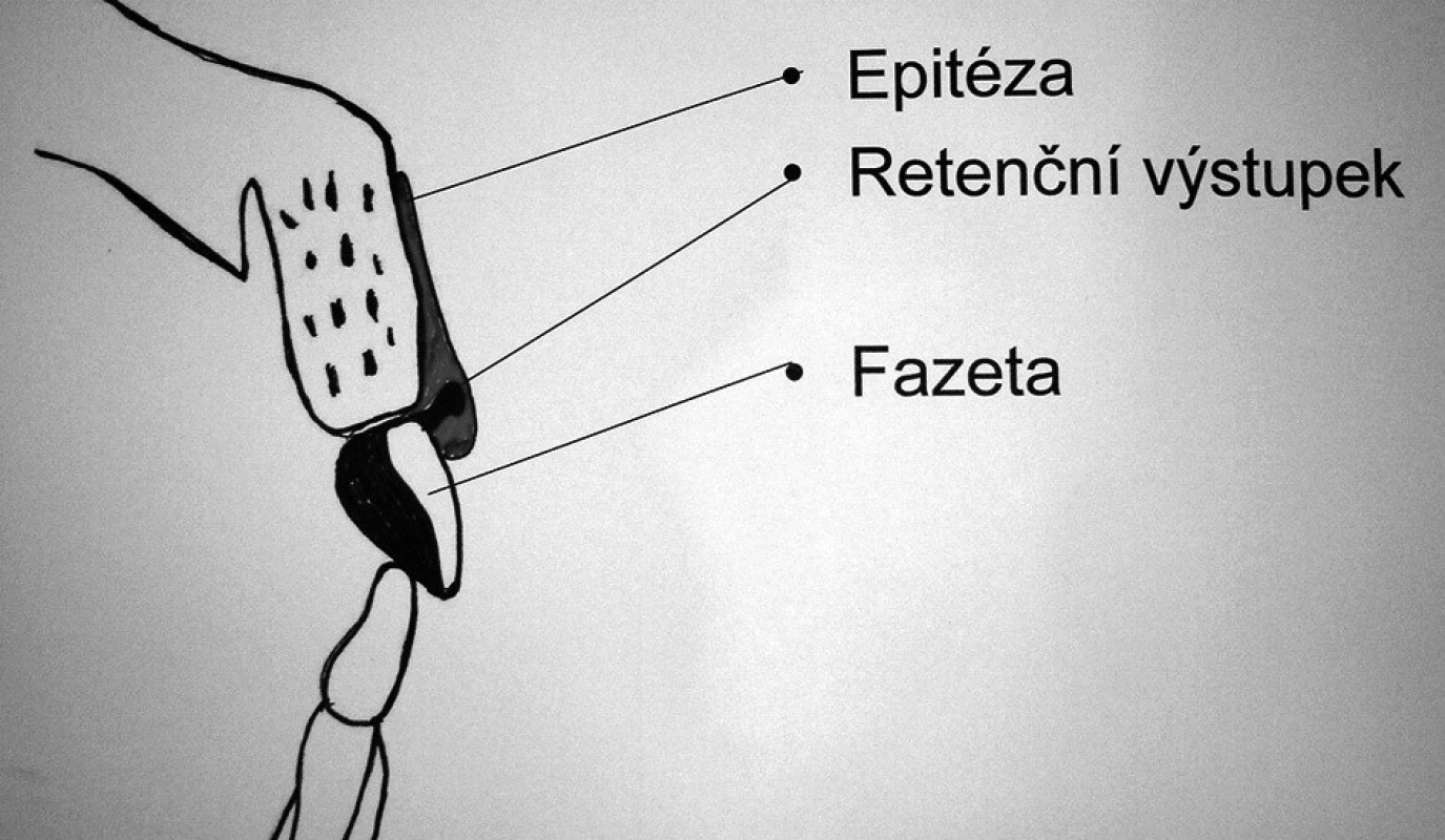 Schéma retenčního mechanismu epitézy.