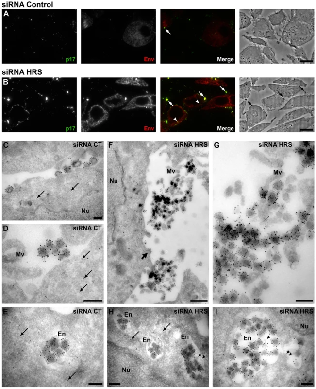 Silencing of HRS leads to accumulation of HIV-1 particles in at the cell surface and in endosomes.