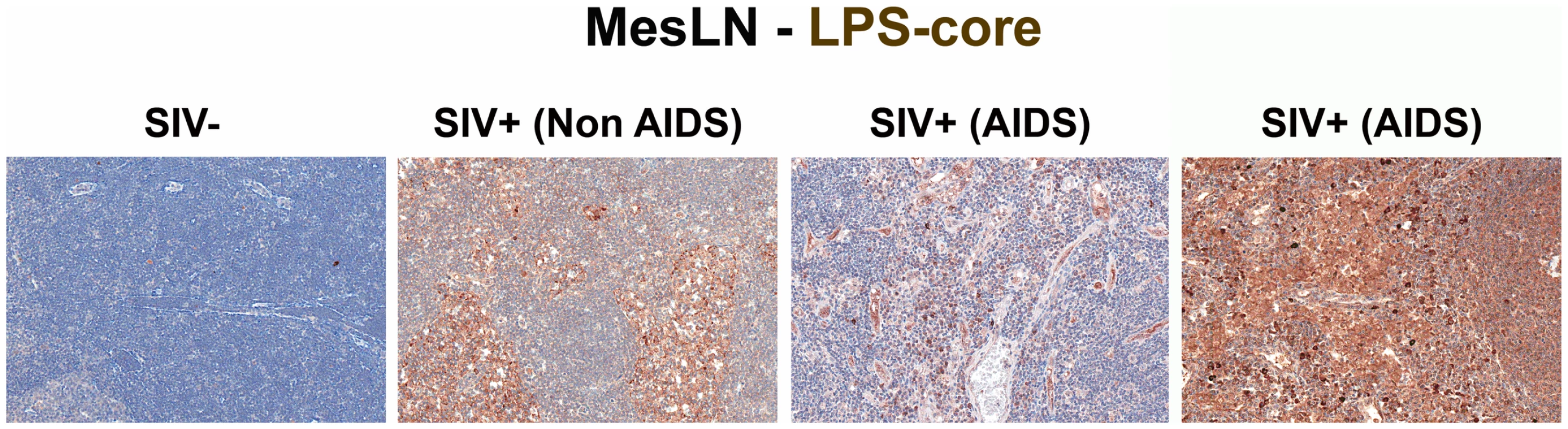 Identification of microbial translocation in gut draining MesLN of chronically SIV<sup>+</sup> RMs.