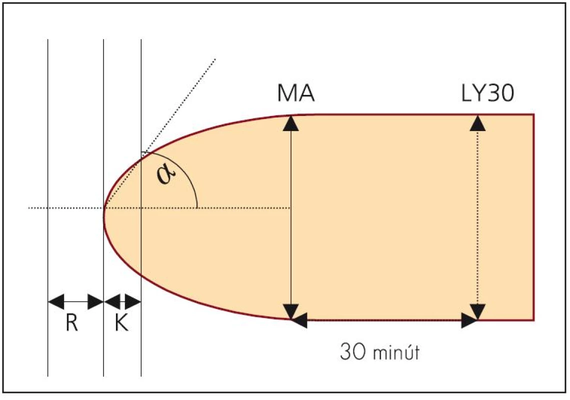 Tromboelastogram – schéma.