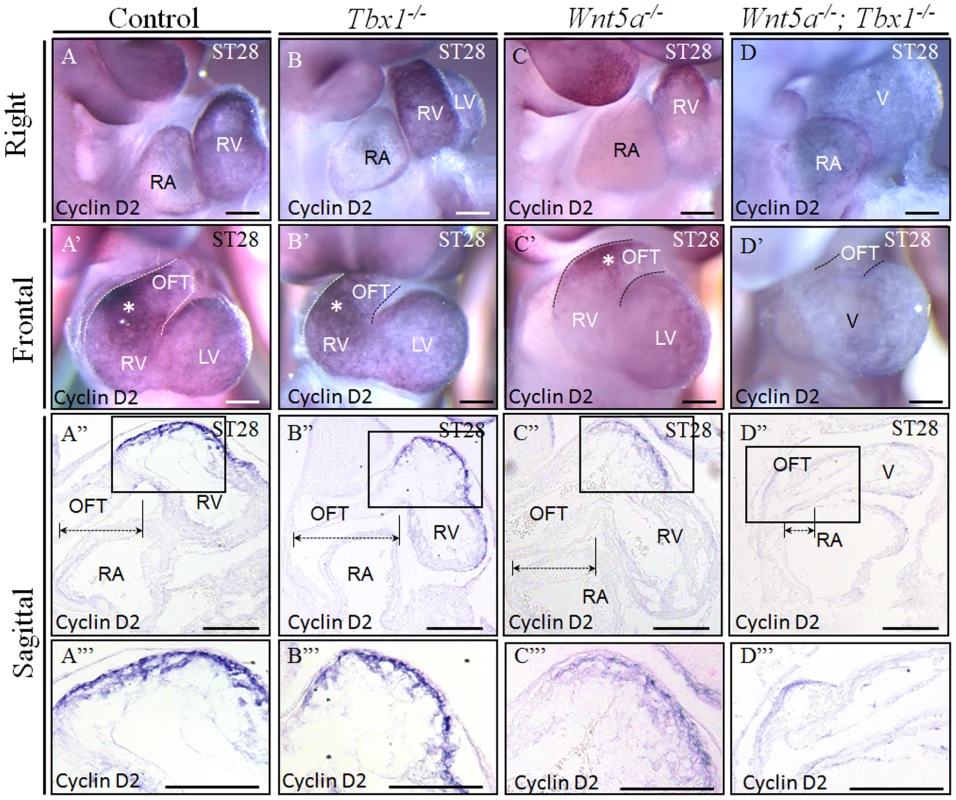 <i>Tbx1<sup>−/−</sup>;Wnt5a<sup>−/−</sup></i> embryos have severe hypoplasia of SHF–derived heart.