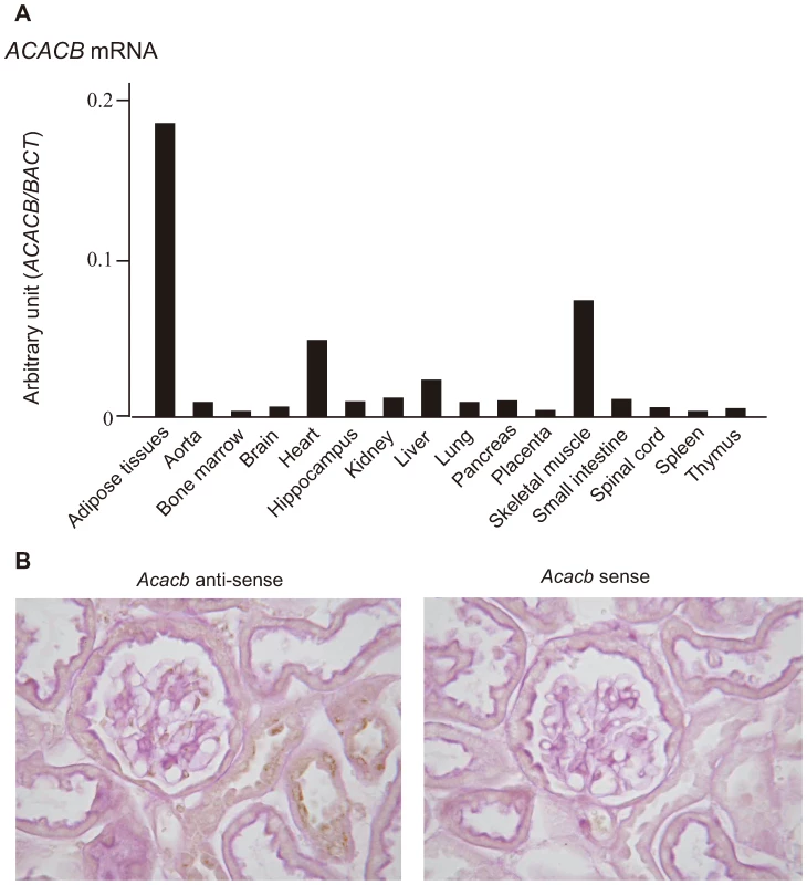 Expression profiles of <i>ACACB</i>.