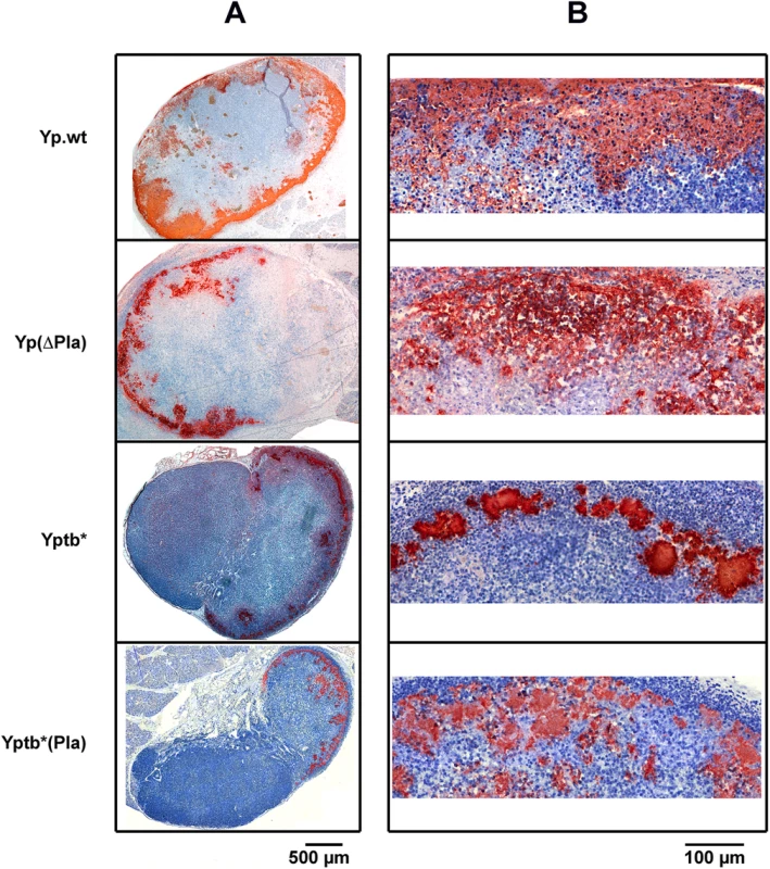 Distribution and infiltration pattern of bacteria in dLNs infected with <i>Y</i>. <i>pestis</i> or <i>Y</i>. <i>pseudotuberculosis</i> strains containing or not the pPla plasmid.