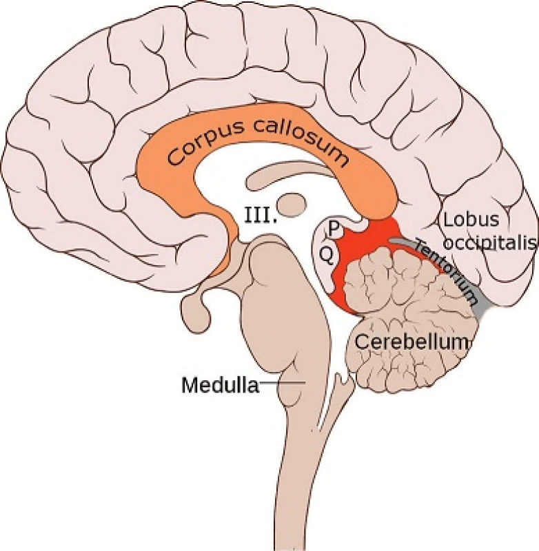 Sagitální řez mozkem:
Anatomický pohled na struktury v blízkosti pineální krajiny (červeně). Zobrazena mj. třetí mozková komora (III.), pineální žláza (P), lamina quadrigemina (Q).
Upraveno dle „Brain bulbar region” autorů Patrick J. Lynch a C. Carl Jaffe, použito na základě CC BY 2.5.
Fig. 1: Sagittal section of the brain:
An anatomical view of the pineal region (in red) and adjacent structures. The third ventricle (III.), the pineal gland (P) and lamina qudrigemina (Q) are depicted.
Adapted from "Skull and brain sagittal" by Patrick J. Lynch and C. Carl Jaffe; used under CC BY 2.5.