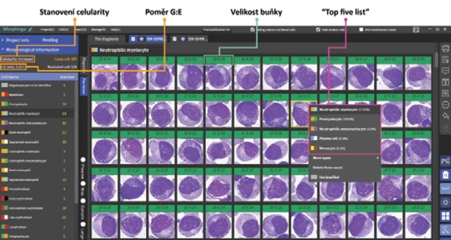 Funkce software MorphogoReview.
