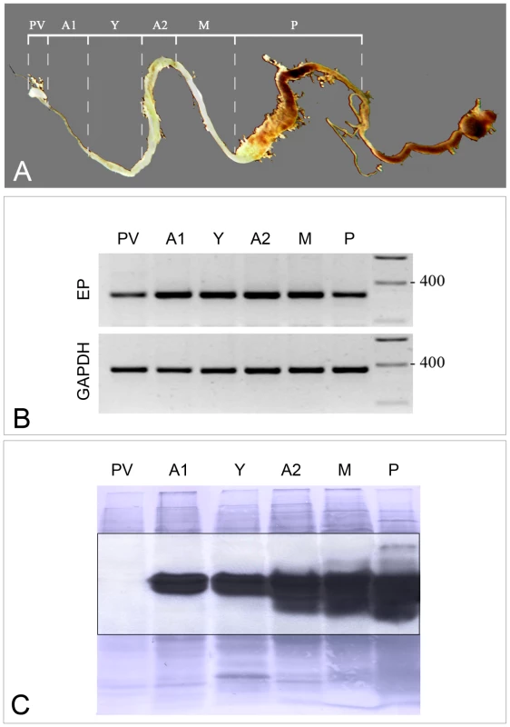Levels of tsetse EP transcripts and proteins in sectioned midguts were determined by semi-quantitative RT-PCR and immunoblotting.