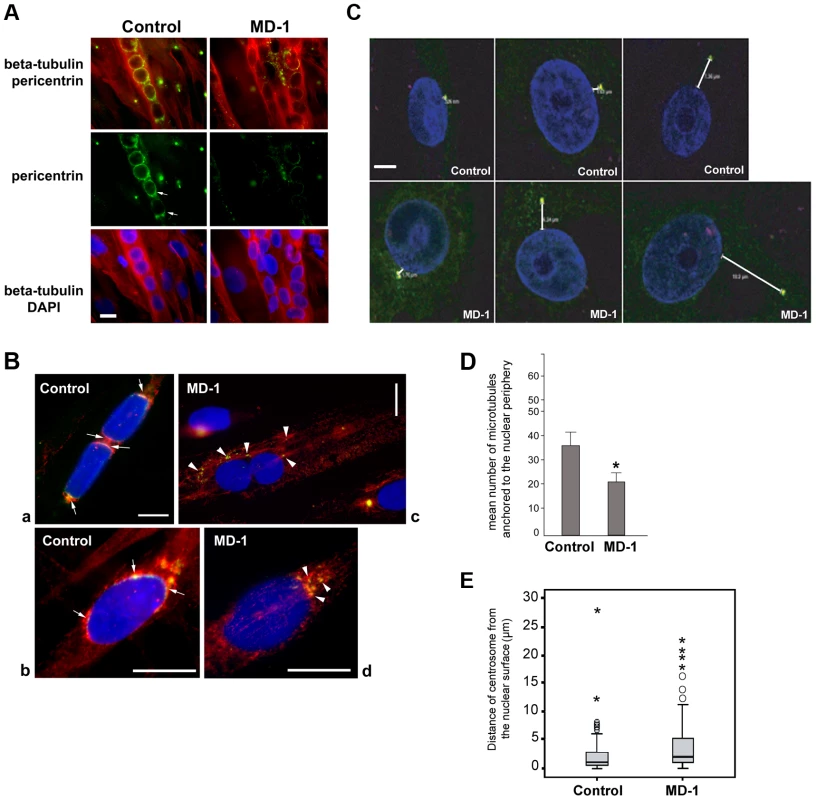 Impaired pericentrin localization and microtubule nucleation at the nuclear envelope in MD-1 myotubes.