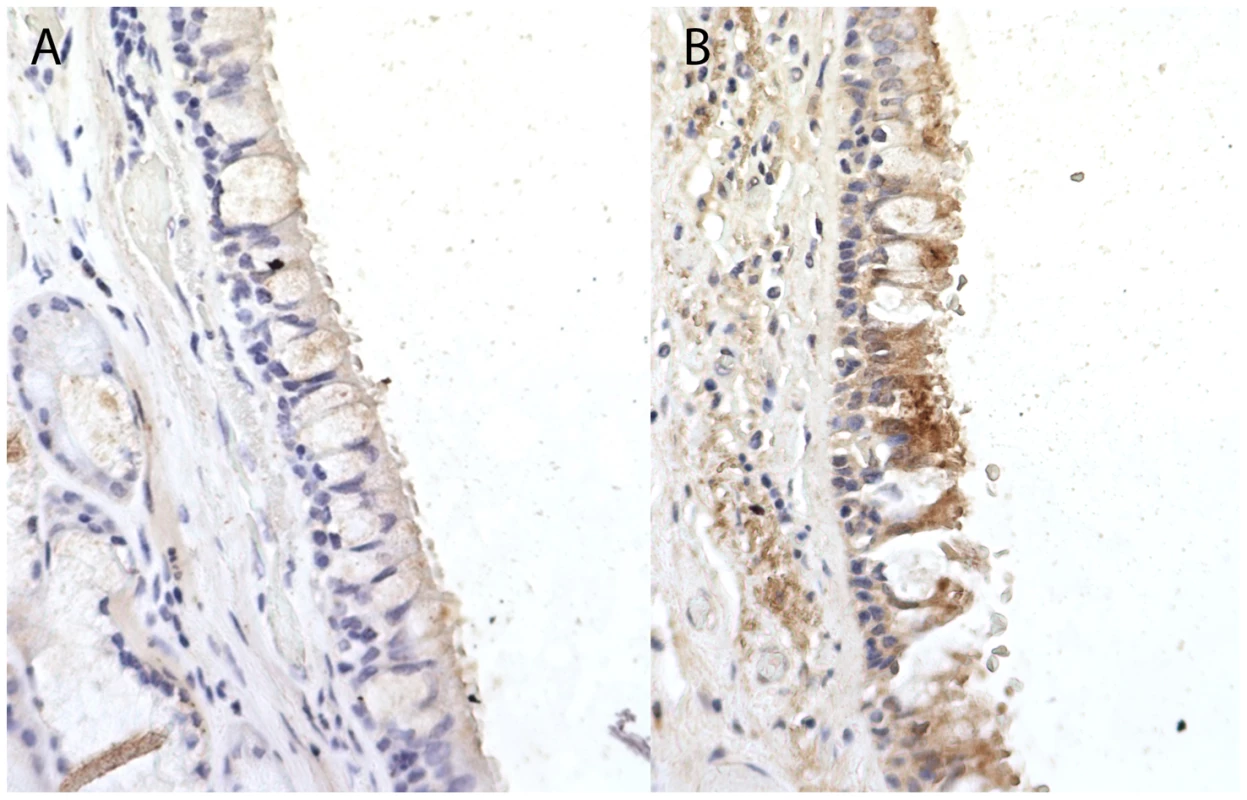 Immunohistochemistry staining for Coiled-Coil Domain-Containing Protein 38 (CCDC38) in a normal human bronchial epithelium at ×40 magnification.