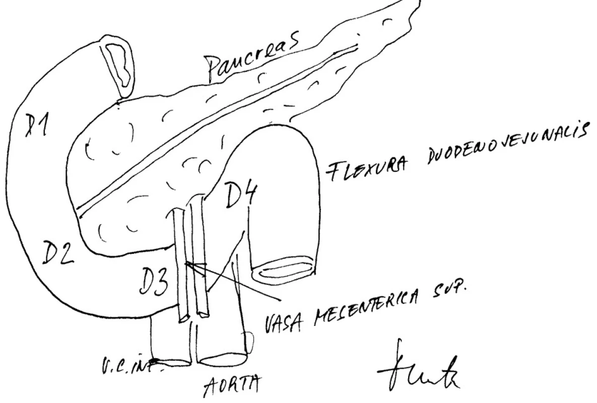 Anatomicko-topografické vztahy duodenopankreatické krajiny
Fig. 4: Anatomical-topographic relations in the duodenopancreaticregion