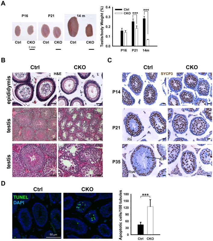 <i>Ikbkap</i> deletion results in germ cell loss in testes.