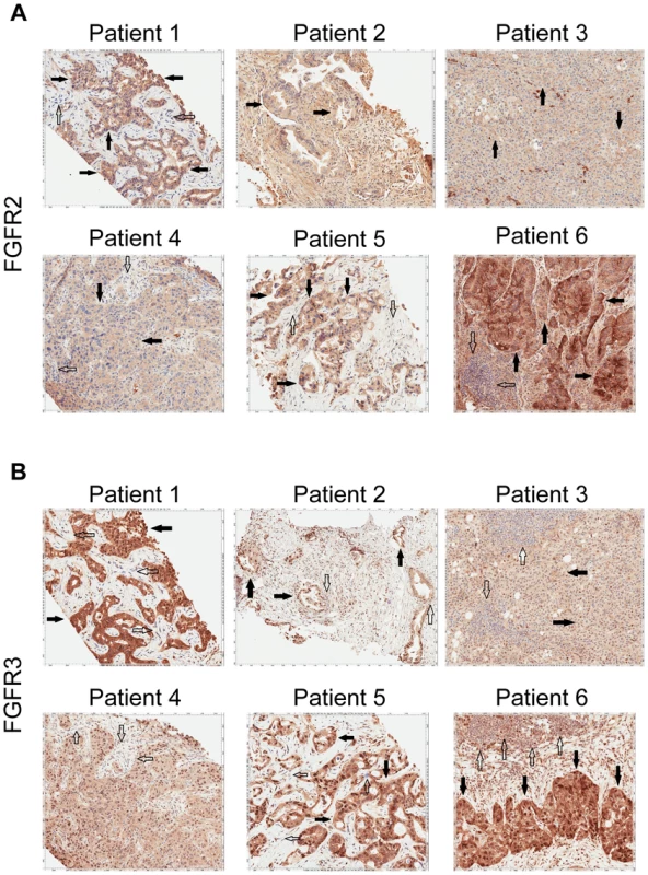 Immunohistochemistry demonstrating FGFR2 and FGFR3 expression.
