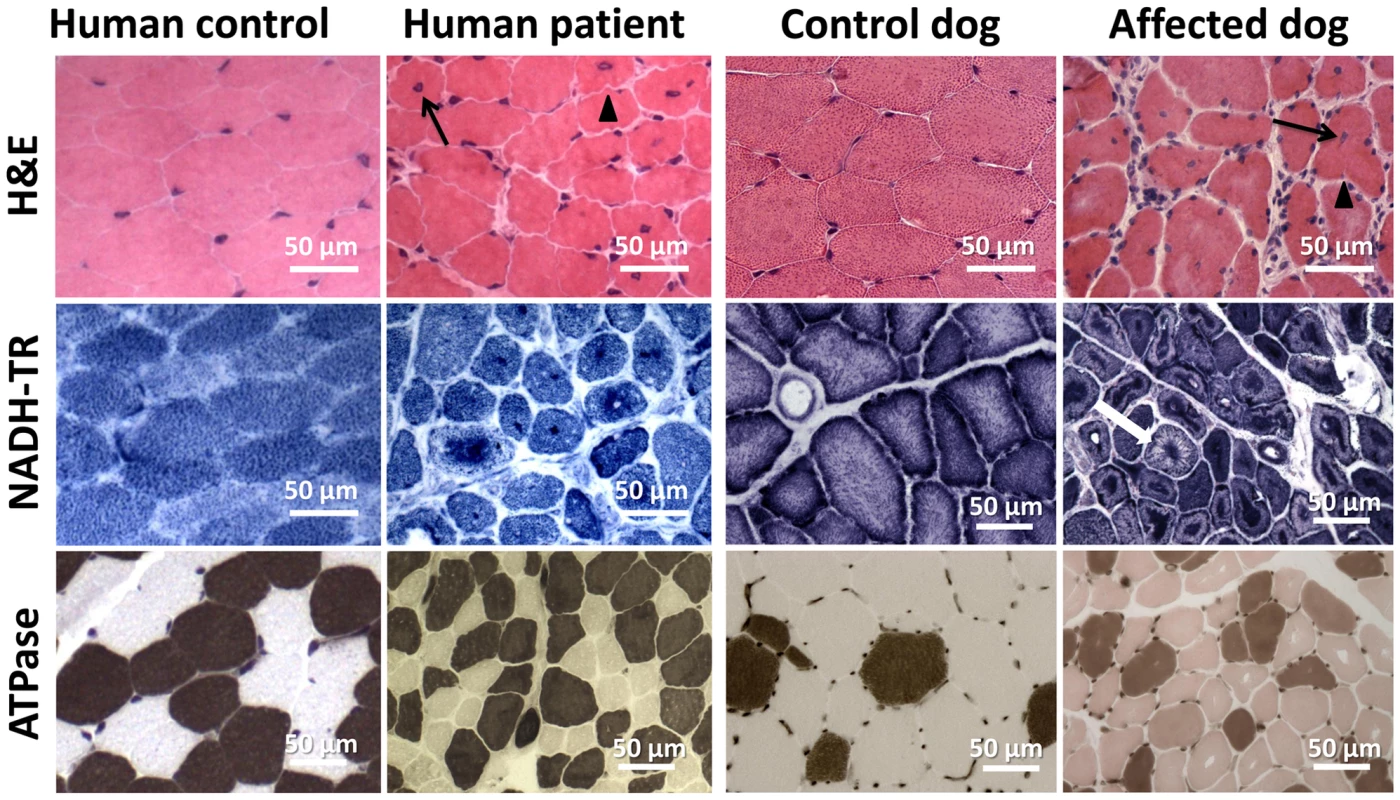 Histopathological comparison of muscles from human patient and IMGD dog.