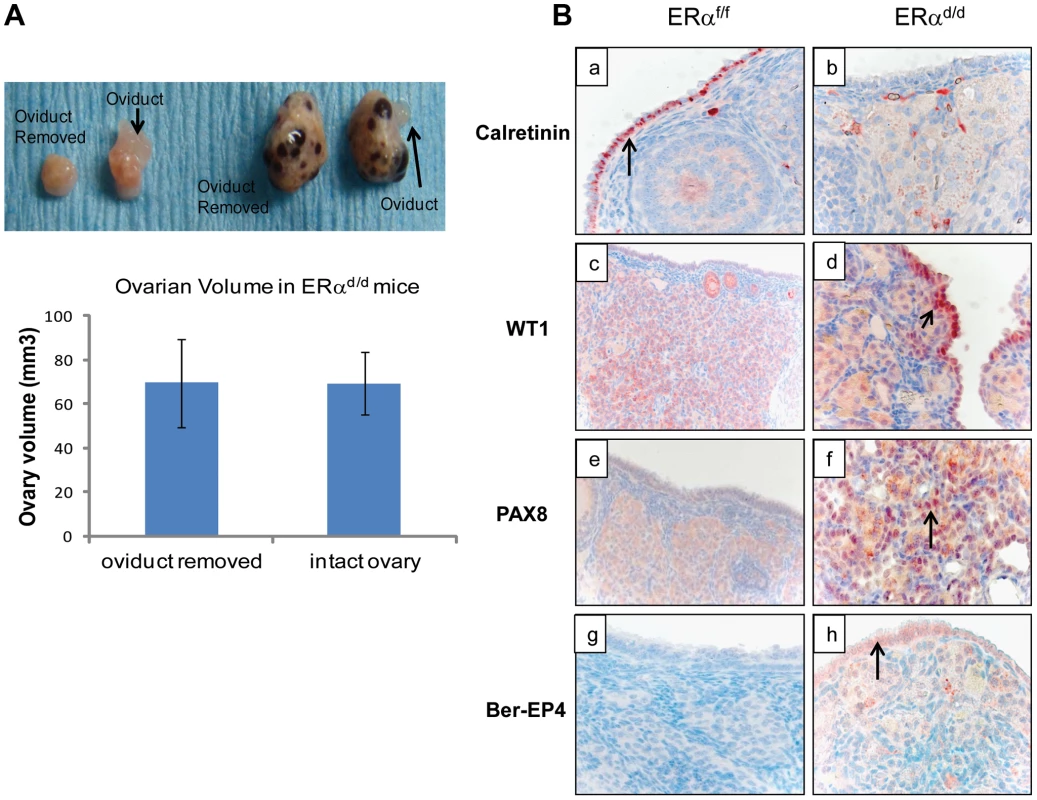 OSE is the site of origin for ovarian tumorigenesis in ERα<sup>d/d</sup> mice.