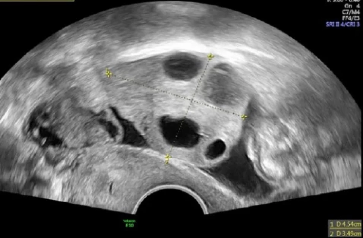  / Fig. 3.