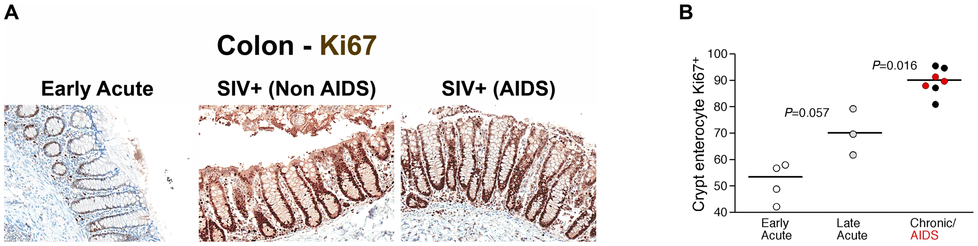 Damage to the integrity of the epithelial barrier is associated with increased enterocyte proliferation.