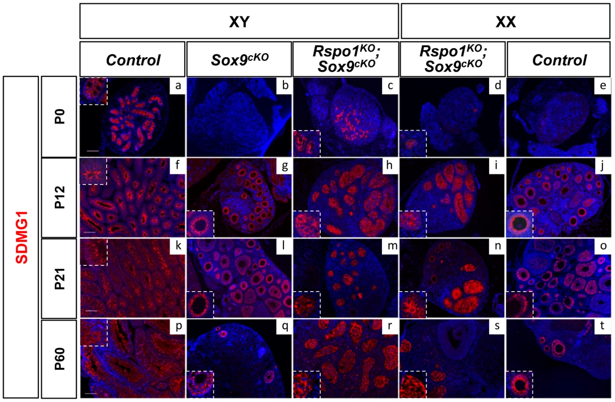 Post-natal development of sex cords in XY and XX <i>Rspo1<sup>KO</sup>Sox9<sup>cKO</sup></i> mice.