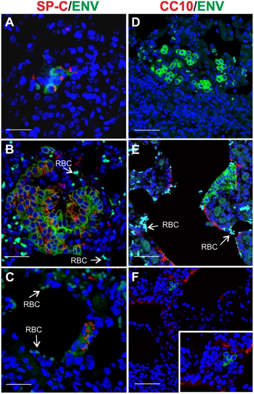 Phenotype of JSRV infected cells in adult sheep with lung injury.