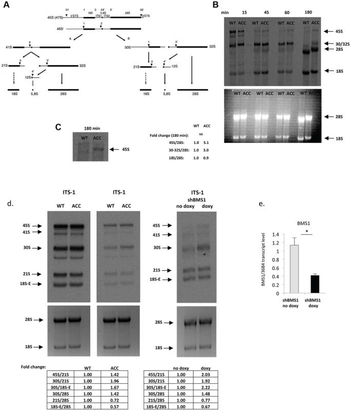 ACC fibroblasts with mutated BMS1 show a delay in 18S pre-rRNA processing.