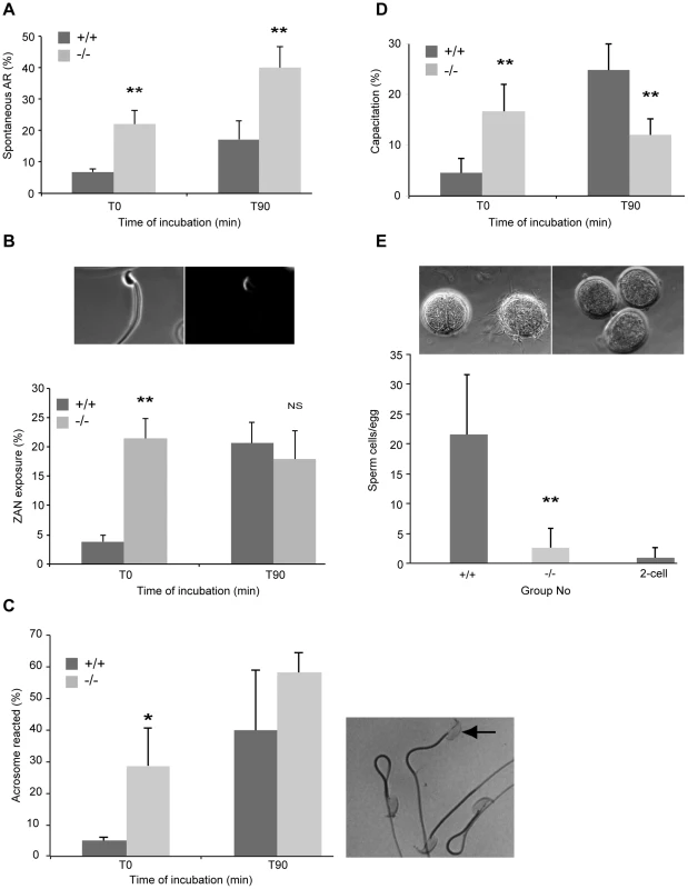 Precocious capacitation and increased spontaneous acrosome reaction in sperm from <i>DefbΔ9/DefbΔ9</i> mice.