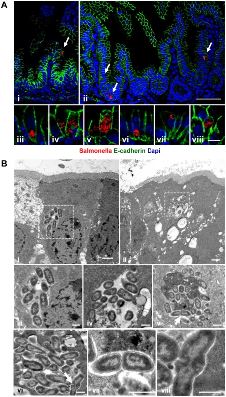 Visualization of intraepithelial <i>Salmonella</i>.