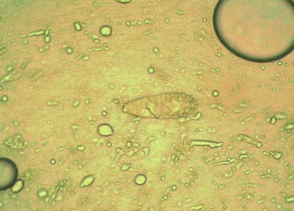 Opakovaný nález Demodex sp. a kandida