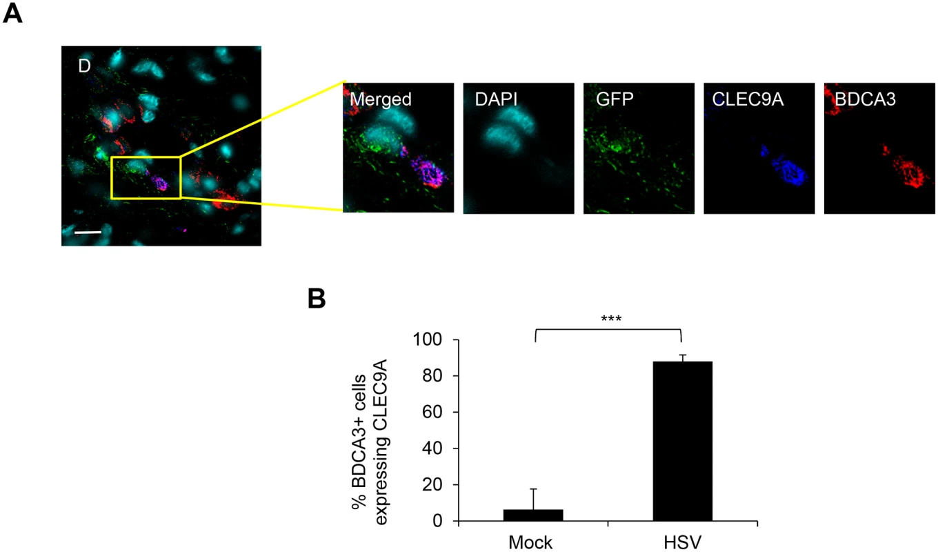 CLEC9A expression by BDCA3<sup>+</sup> dermal DCs in HSV-1 infected foreskin explants.