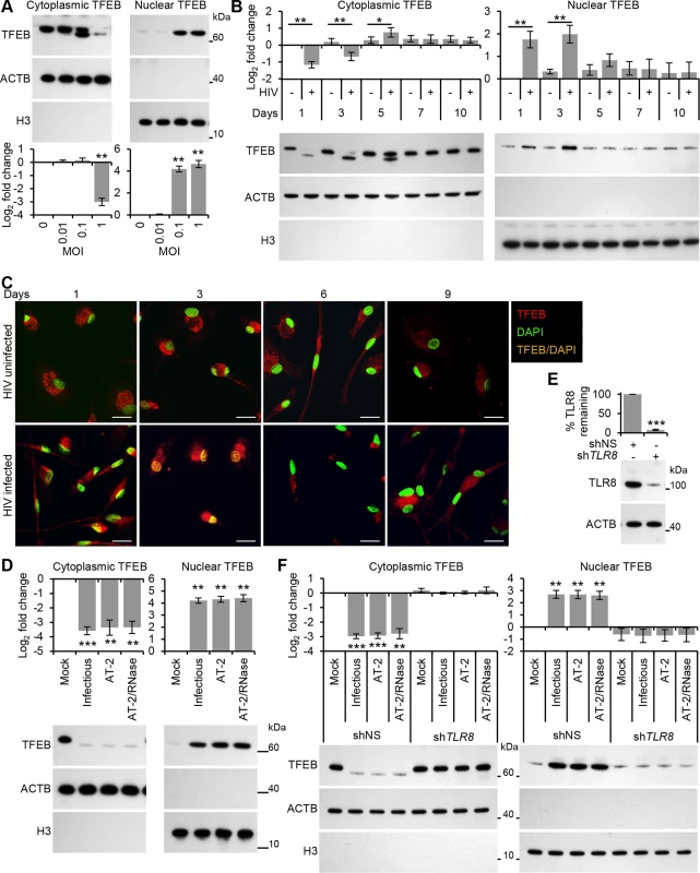 HIV induces TFEB nuclear localization in human macrophages through TLR8.
