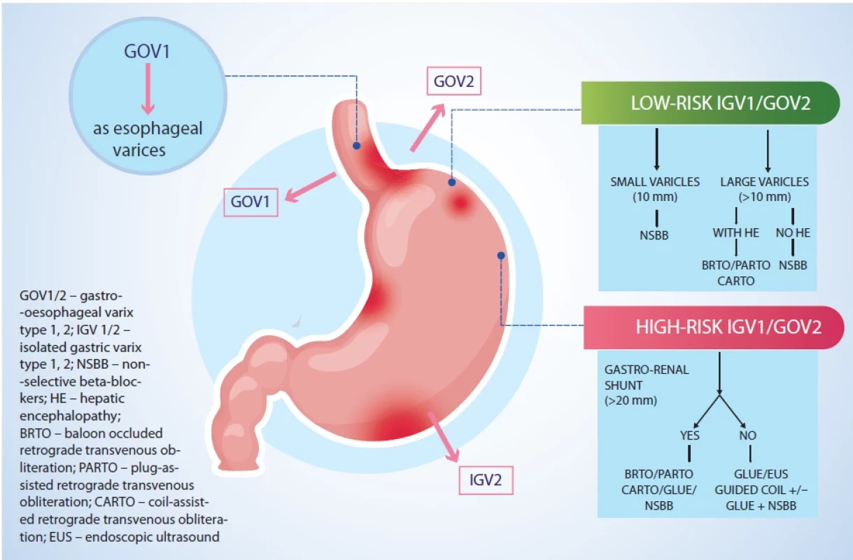 A diagram showing the management of gastric varices.