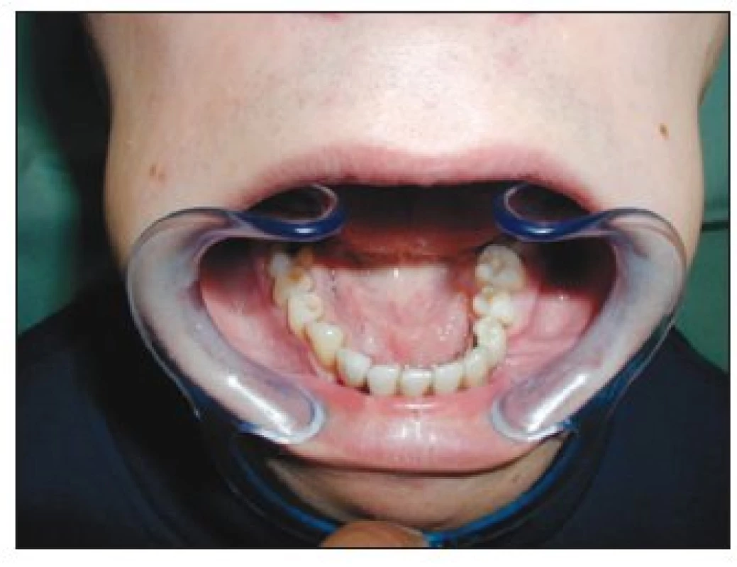 Occlusal view