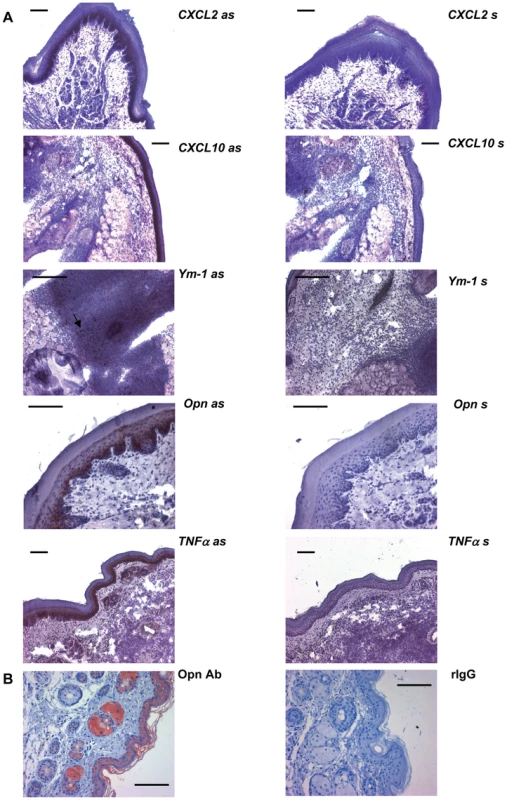 <i>In-situ</i>-hybridization and immunohistochemistry.