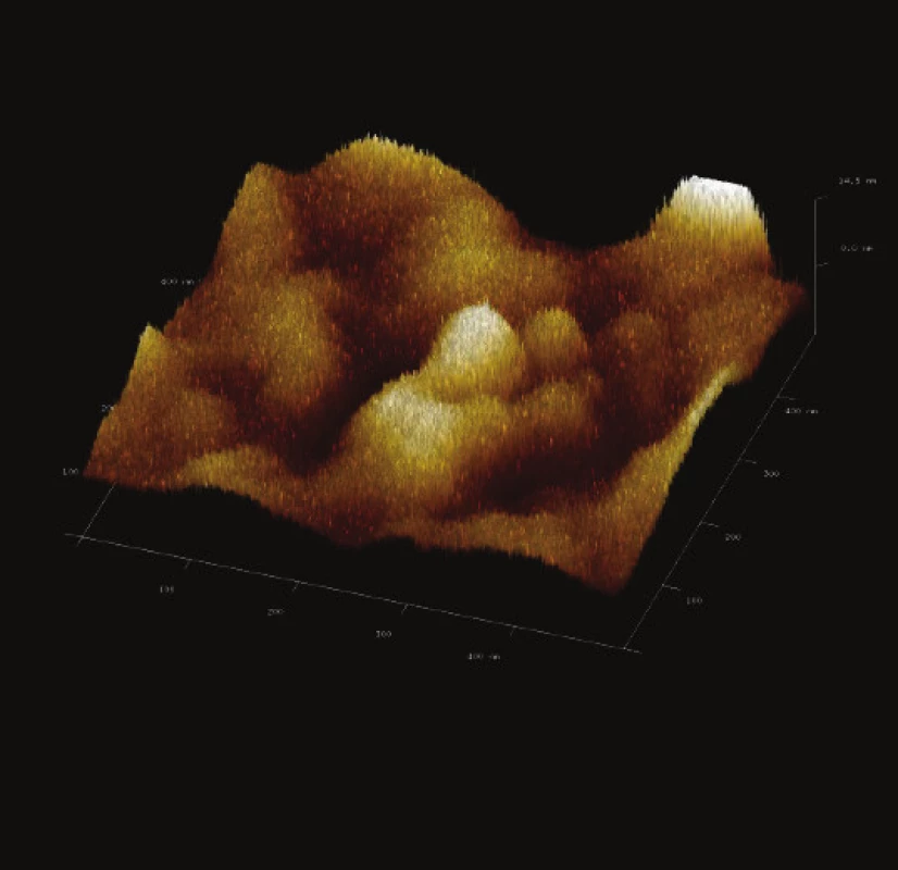 3-D zobrazení jemného detailu povrchové struktury magnetického nosiče PGMA-COOH. Vložené měřítko odpovídá 100 nm. Skenovaná oblast 500x500 nm<sup>2</sup>, Z – rozsah 14 nm. 