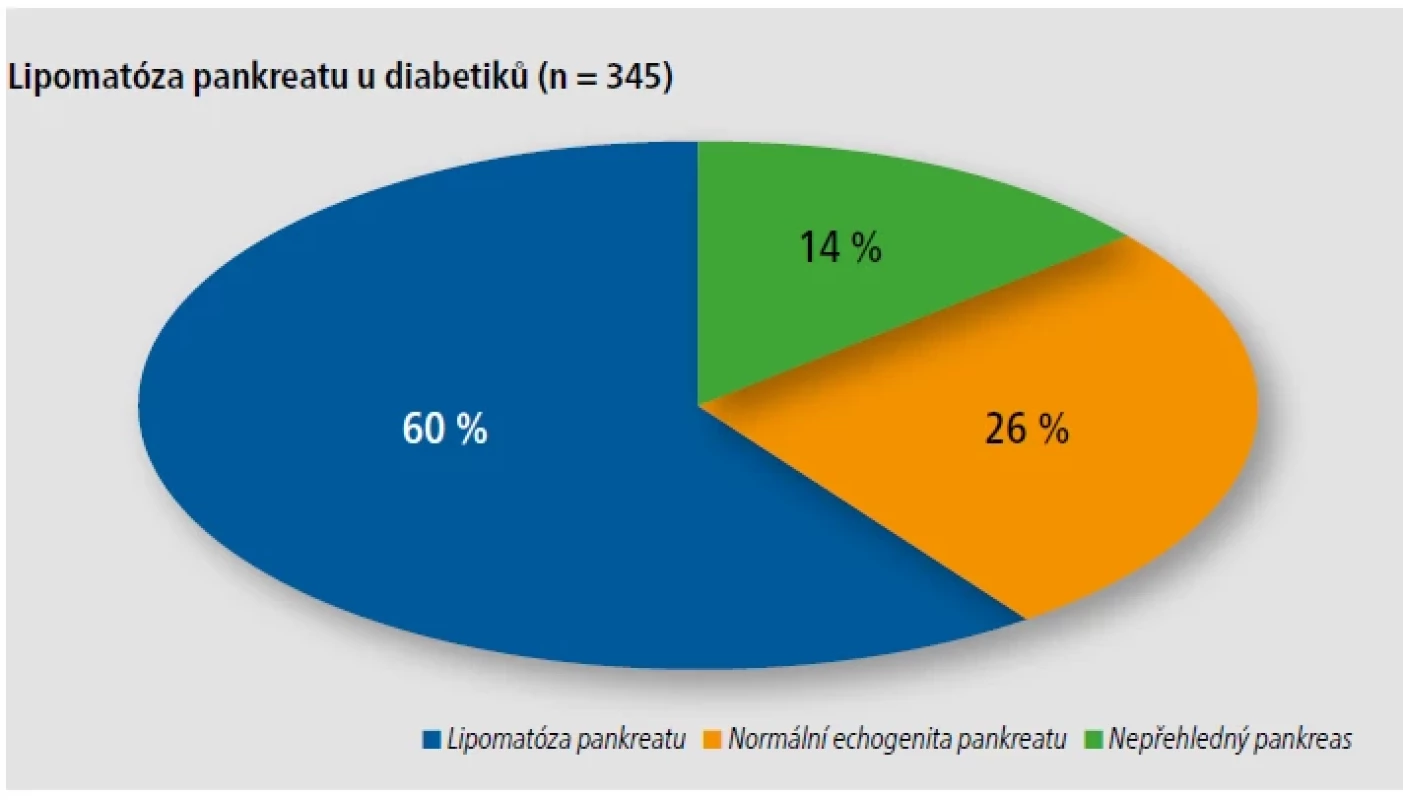 Prevalence lipomatózy pankreatu u diabetiků během jednoho roku na pracovišti na klinice Restrial.