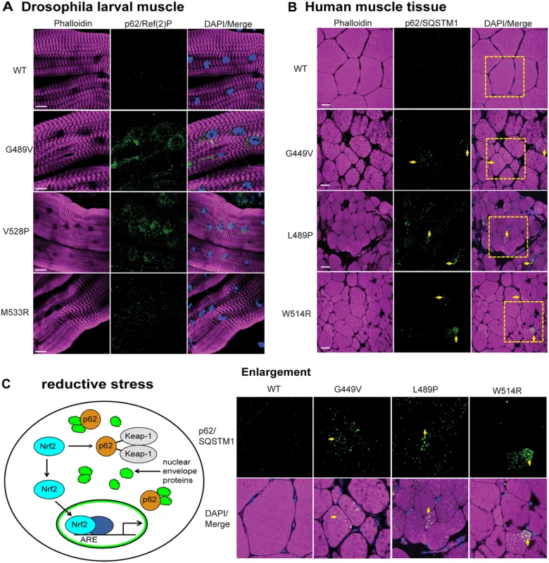 Mutant lamins cause increased levels of p62/SQSTM1 in Drosophila muscles and human muscle biopsy tissues.