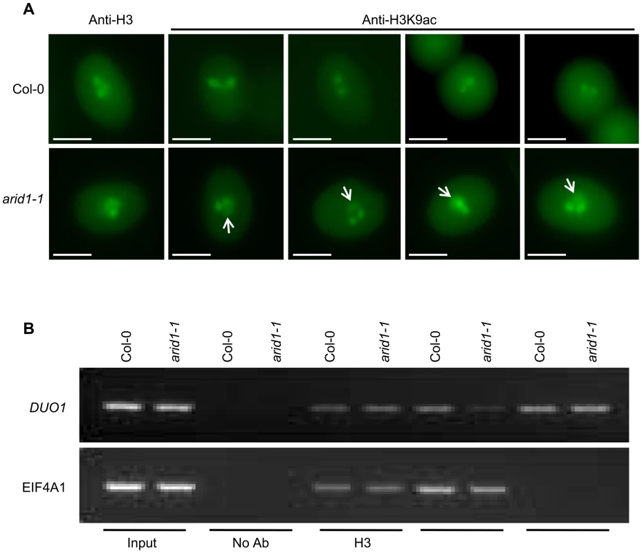 Altered histone acetylation in <i>arid1-1</i>.