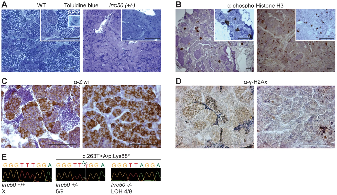 Characterization of <i>lrrc50<sup>Hu255h</sup></i> zebrafish TGCT suggests analogy to human seminoma.