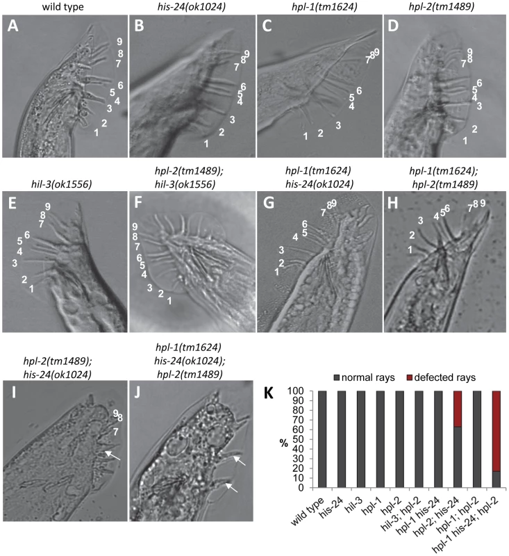 <i>his-24</i> and <i>hpl-2</i> genes are involved in proper postembryonic development of male-specific structures.