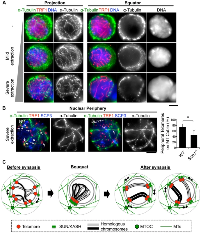 MTs dynamics in spermatocytes.