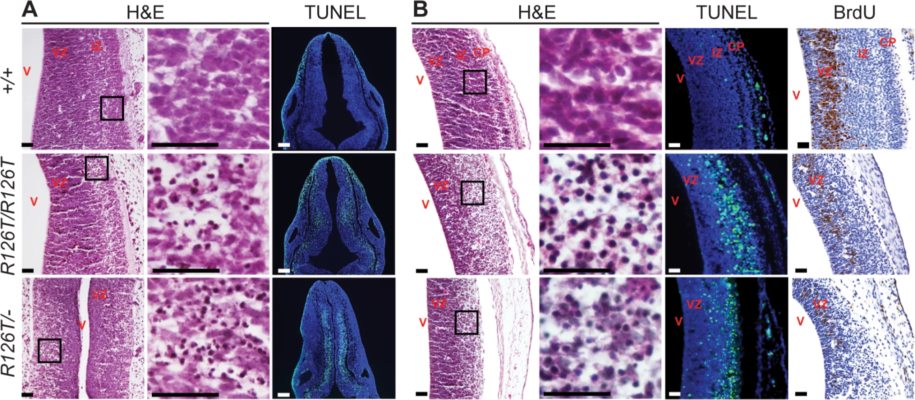 SDS brain is apoptotic.