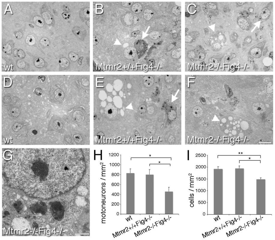 Semithin section analysis of spinal cord from <i>Mtmr2</i>+/+<i>Fig4</i>−/− and <i>Mtmr2</i>−/−<i>Fig4</i>−/− mice.