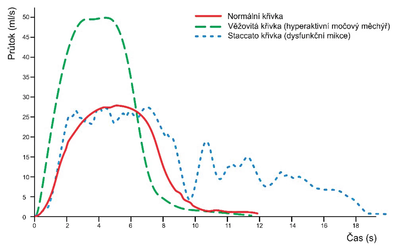 Uroflowmetrické křivky.