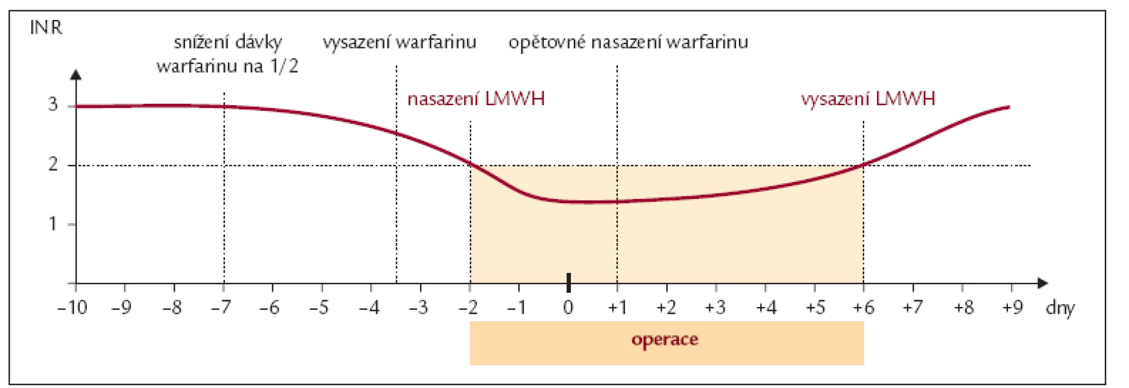 LMWH jako „přemosťující“ léčba.