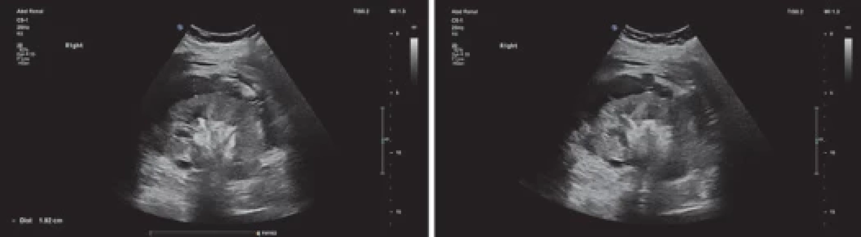 Sonografie