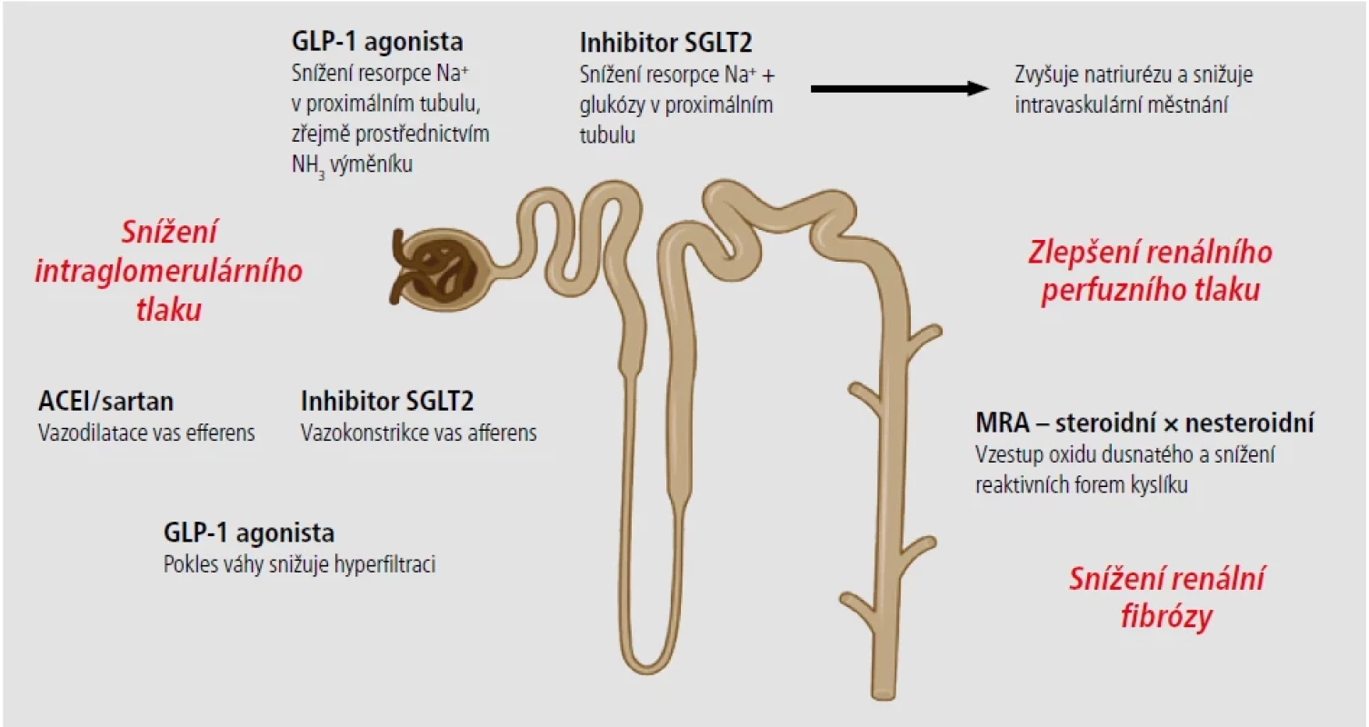 Možnosti ovlivnění albuminurie a CKD současnou farmakologickou léčbou.