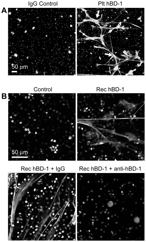 β-defensin 1 induces NET formation by PMNs.