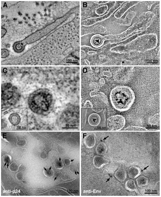 Virion structures in HIV-1–infected GALT.